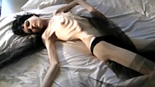 Anorexic stasha