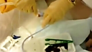 Injection of masculine catheter excruciating