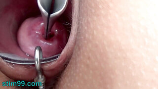 Extraordinary Cervix Toying with Injection Iron Shackle in Uterus
